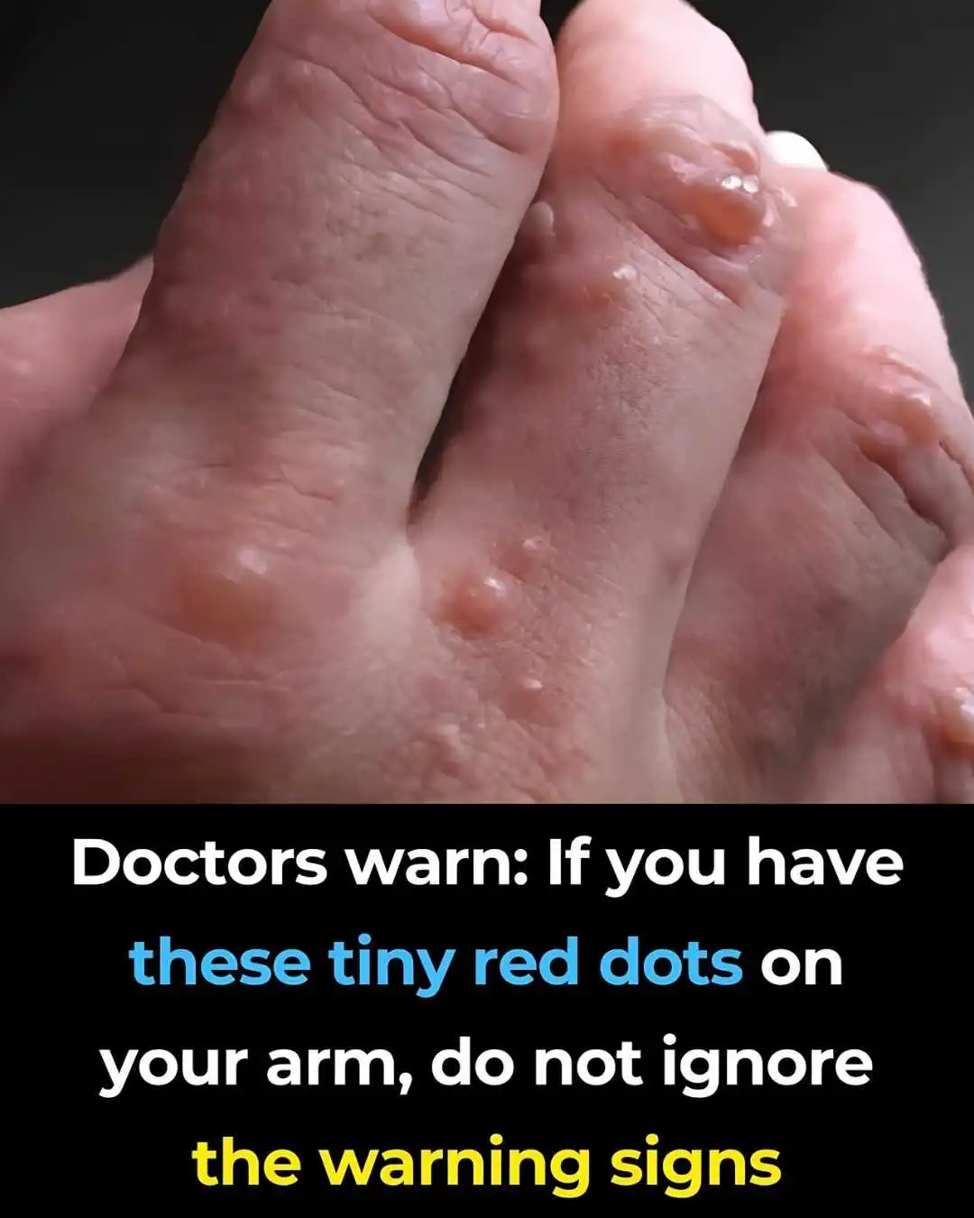 Small Red Spots on Your Arm